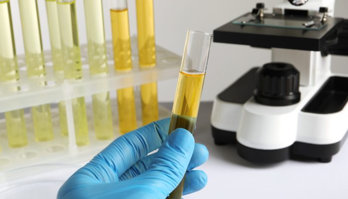 Nurse holding tube with urine sample for analysis in laboratory, closeup